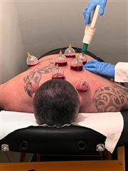 Hijama Cupping Begic in Rotterdam foto 2